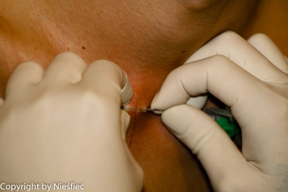 piercing_morbida_20111205_1134492424